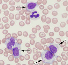 Immunophenotyping Tests